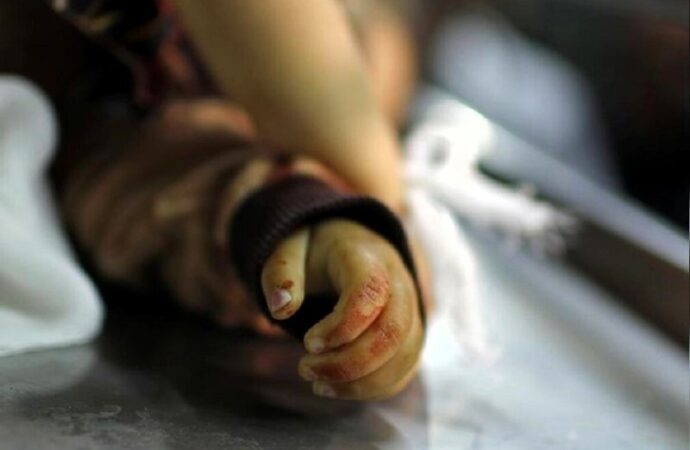 Gaza, attacco a Shujaya: almeno 29 morti e quasi 80 dispersi