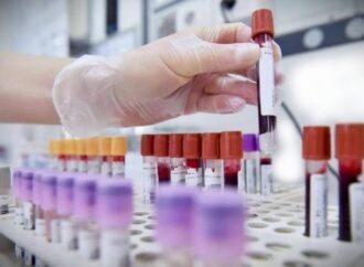 Ue, l’influenza aviaria si diffonde, 60 focolai in 3 settimane