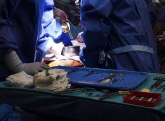 Malattia cronica da trapianto contro l’ospite, via libera Ue a belumosudil