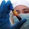 Hantavirus, negativo il turista inglese in quarantena a Milano. Test donna ricoverata a Messina