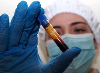 Hantavirus, negativo il turista inglese in quarantena a Milano. Test donna ricoverata a Messina