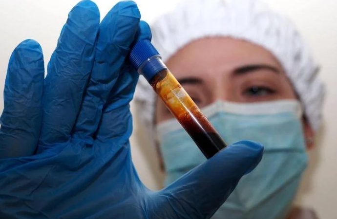 Hantavirus, negativo il turista inglese in quarantena a Milano. Test donna ricoverata a Messina